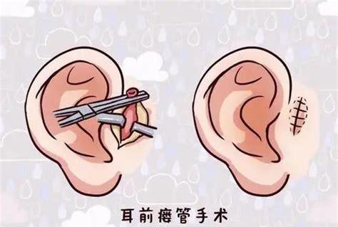 耳朵旁的笔顺是什么(掌握汉字的基本笔画和常用的偏旁部首)