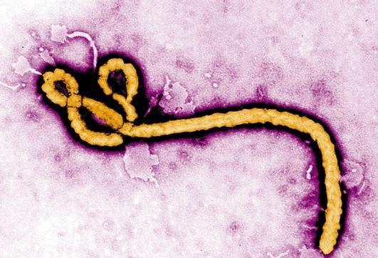 埃博拉病毒为什么会突然消失(埃博拉在中国有没有出现)